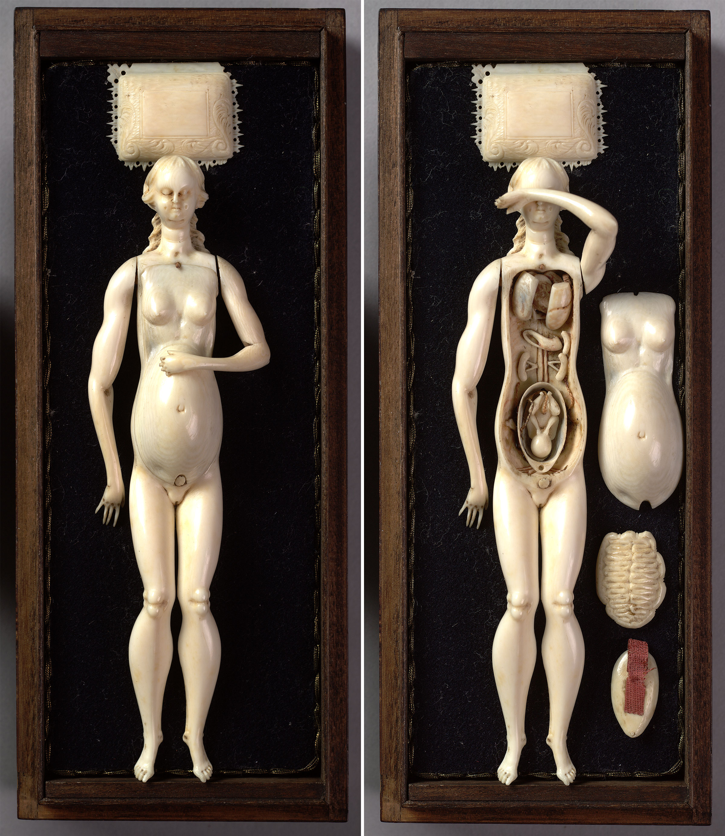 Side-by-side photos of a small wooden box holding an ivory figure of a woman (left) and "open" with anatomical body parts both inside and next to the body (right).