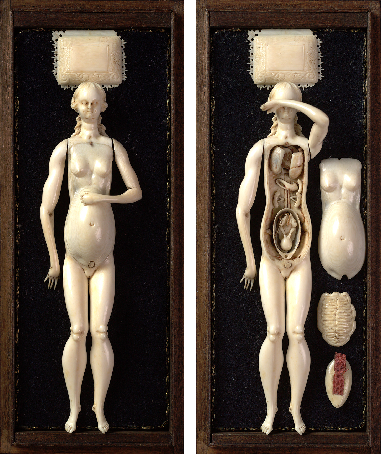 A composite of a white medical figurine on a dark background: a pregnant figure (left) and the figure with the torso removed to reveal organs.