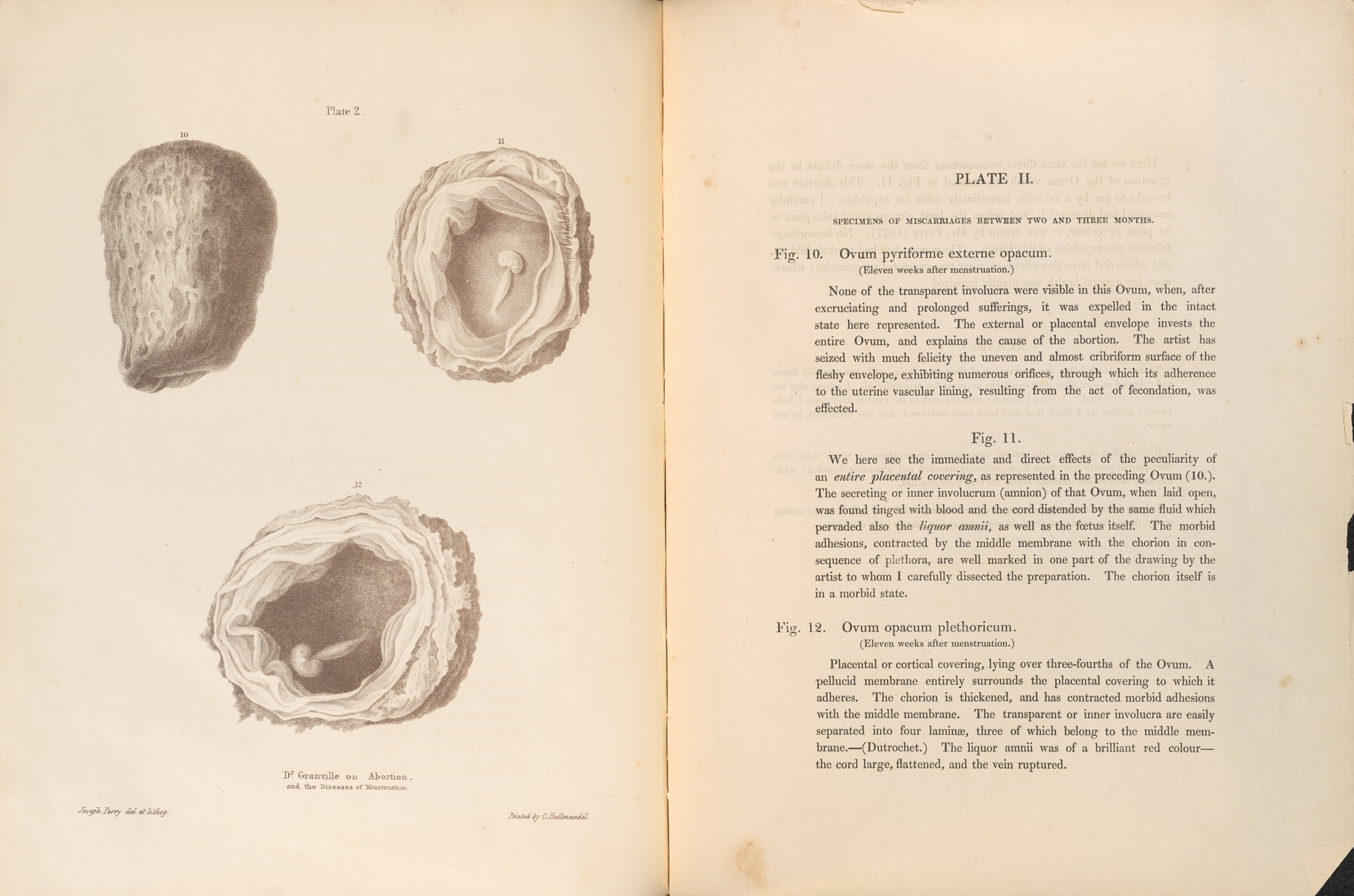 An open book with medical illustrations of embryos (left) and descriptions.