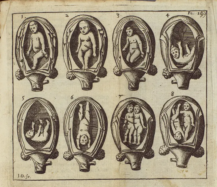 Printed illustration of two rows of four uteruses. Each uterus contains a near-term fetus in a different position.