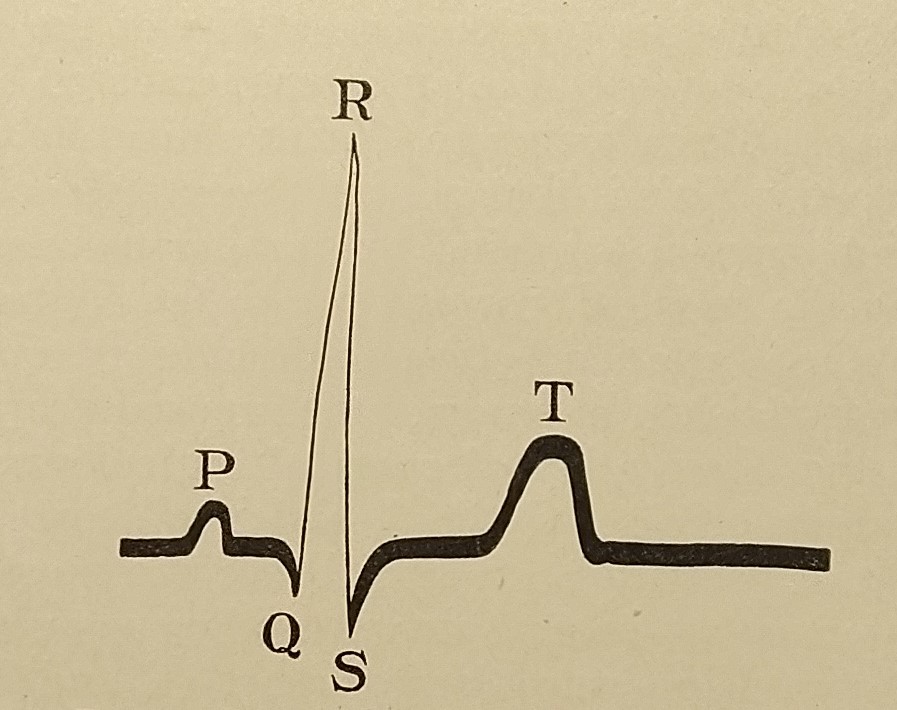 Walter B. James and Horatio B. Williams, “The Electrocardiogram in Clinical Medicine,” American Journal of the Medical Sciences, 1910.