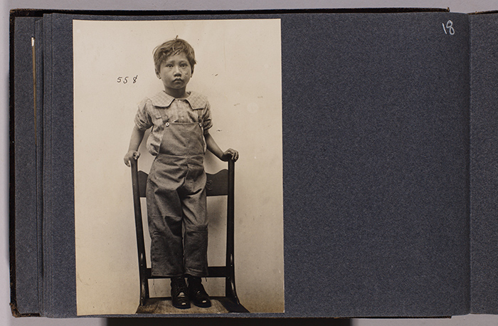 Hiram Pahau (case 558), age 7, from Ala Moana near John Ena Road, admitted Oct. 27, 1905. Jack London Collection. The Huntington Library, Art Collections, and Botanical Gardens.